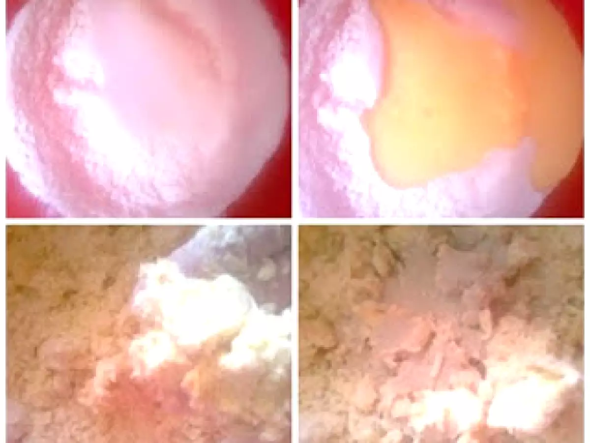 Gogosi inelus - poza 3